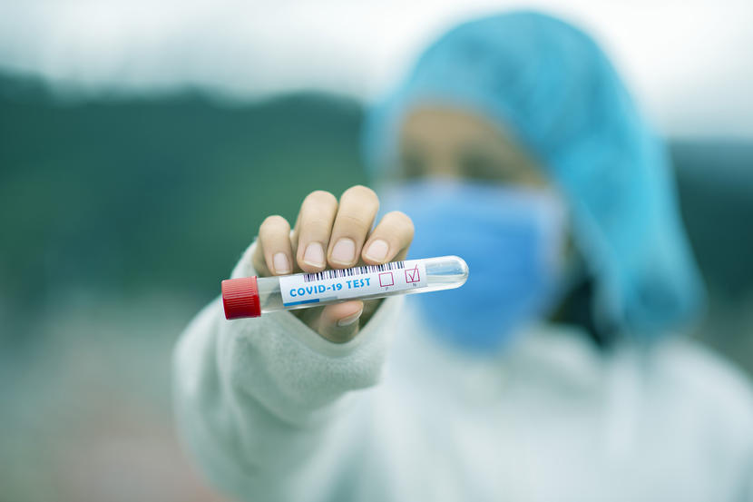 Where To Get The Rapid Dhs50 Laser Covid 19 Tests In Abu Dhabi News Time Out Abu Dhabi